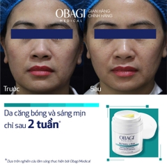 Obagi Medical Retinol + PHA Refining Night Cream: Kem Dưỡng Tái Tạo Da Chuyên Sâu, Làm Mịn Và Đều Màu Da Ban Đêm