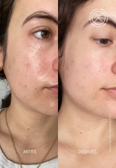 Transparent Barrier Restoring Hydrating Cream – Kem Dưỡng Ẩm Sâu, Củng Cố Hàng Rào Bảo Vệ Da Và Ngăn Ngừa Các Dấu Hiệu Tuổi Tác
