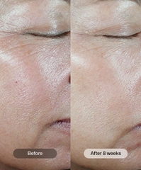 REVISION C+ Correcting Complex 30% – Tinh Chất Vitamin C Cao Cấp Chống Oxy Hoá Dưỡng Sáng, Làm Mều Màu 