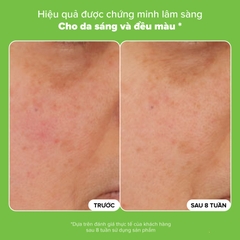 Nước cân bằng độ ẩm và thu nhỏ lỗ chân lông Skin Balancing Pore-Reducing Toner