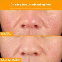 Tinh chất làm sáng da, mờ thâm nám và giảm nếp nhăn chứa 15% Vitamin C C15 Super Booster 20ml