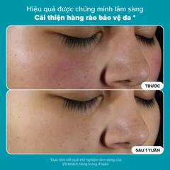 Dung dịch loại bỏ tế bào chết Skin Perfecting 2% BHA Liquid Exfoliant
