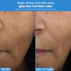 Tinh chất 3 tác động chống lão hóa, mờ thâm nám, giảm nếp nhăn và săn chắc da Resist Triple Active Total Repair Serum 30ml