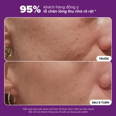 Tinh chất giúp thu nhỏ lỗ chân lông và làm sáng da 10% Niacinamide Booster 20ml