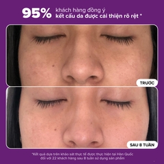 Nước cân bằng độ ẩm và thu nhỏ lỗ chân lông Skin Balancing Pore-Reducing Toner