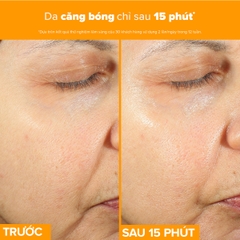 Tinh chất làm sáng da, mờ thâm nám và giảm nếp nhăn chứa 15% Vitamin C C15 Super Booster 20ml
