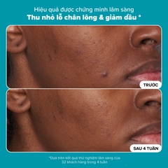 Dung dịch loại bỏ tế bào chết Skin Perfecting 2% BHA Liquid Exfoliant