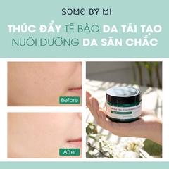 Kem Dưỡng Giảm Mụn Some By Mi AHA-BHA-PHA 30 Days Miracle Cream 60g