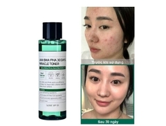 Nước Hoa Hồng Cho Da Mụn Some By Mi AHA-BHA-PHA 30 Days Miracle Toner 150ml