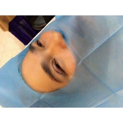 Săng Mổ Đã Tiệt Trùng Không Lỗ