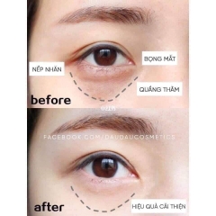 Kem mắt Estee Lauder