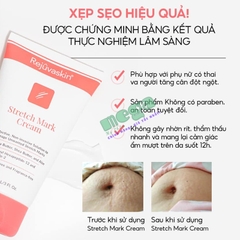 Kem Trị Rạn Da Rejuvaskin Stretch Mark Cream 90ml [Chính Hãng]