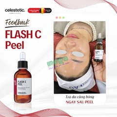 Celestetic Flash C Peel - Peel Căng Bóng Tức Thì, Không Cần Trung Hòa