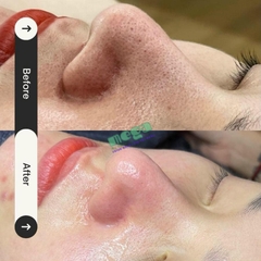  Histolab Aqua Peeling Solution BHA 520ml