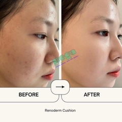 Phấn Nước RENODERM Daylong BB Cream Cushion [Chính Hãng]