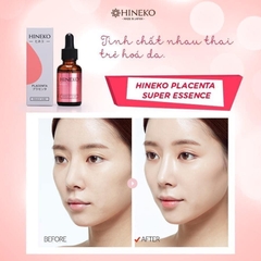 Hineko Placenta Super Essence – Tinh chất nhau thai tái sinh da, nâng cơ