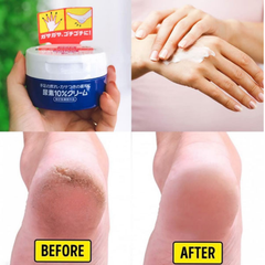 Kem Trị Nứt Gót Chân, Ngón Tay Shiseido UREA Cream - 100gr