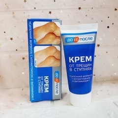 Kem Hỗ Trợ Cải Thiện Nứt Gót Chân Kpem Apteka 50ml Nga