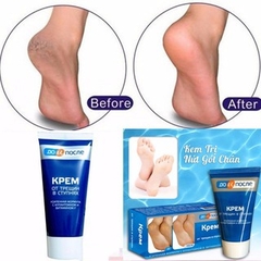 Kem Hỗ Trợ Cải Thiện Nứt Gót Chân Kpem Apteka 50ml Nga