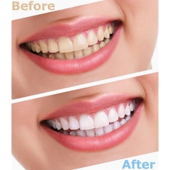 Combo BỘT + KEM đánh tẩy trắng răng Eucryl Anh Quốc