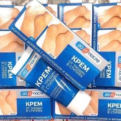 Kem Hỗ Trợ Cải Thiện Nứt Gót Chân Kpem Apteka 50ml Nga