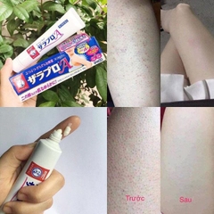 Kem Viêm Nang Lông Rohto Zaraporo 35g Nhật Bản