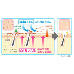 Kem Viêm Nang Lông Rohto Zaraporo 35g Nhật Bản