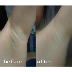 Xà Phòng PELICAN Ngừa Thâm Và Làm Trắng Vùng Nách NHẬT BẢN 100g