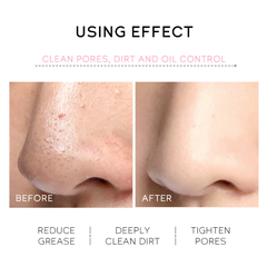 Mặt Nạ Gel Lột Mụn Đầu Đen Cho Mũi & Mặt Làm Sạch Mụn Cám, Bụi Bẩn, Lông Tơ Trên Mặt