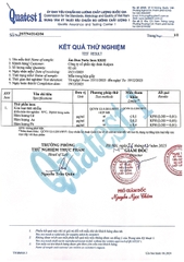 Ấm đun nước Inox 5 lớp đáy Kalpen KK02 2.5L