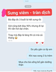 CAO ĐẮP XƯƠNG KHỚP CẤP TÍNH ( VIÊM, SƯNG, TRÀN DỊCH KHỚP)