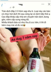 CAO ĐẮP XƯƠNG KHỚP CẤP TÍNH ( VIÊM, SƯNG, TRÀN DỊCH KHỚP)