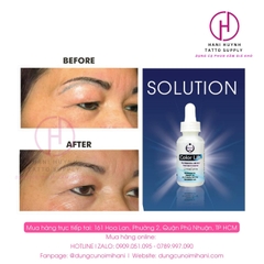 Xóa Xăm Color Lift Dùng Trong Phun Xăm Thẩm Mỹ