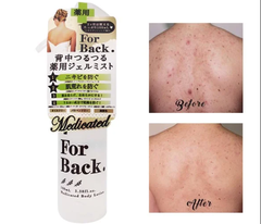 Xịt mụn lưng Forback
