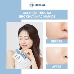 Mặt Nạ Giấy Mediheal Essential Mask Dưỡng Da Mềm Mịn Và Trắng Sáng - 24ml