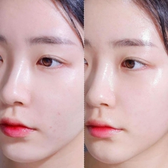 Serum dưỡng ẩm ISOI Blemish Care Up tinh chất dưỡng trắng da - mờ thâm nám chiết xuất hoa hồng 15ml