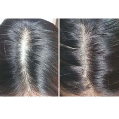 Bộ gội xả chống rụng tóc Pretty Skin Bio Solution Scalp Shampoo giữ tóc chắc khỏe và bóng đẹp 500ml