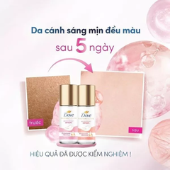 Lăn khử mùi Dove dưỡng nách giảm thâm sáng da - Lăn nách dove ngăn mùi sáng da Collagen Vitamin C E