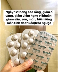 BioGaia Prodentis viên ngậm nha khoa 30V
