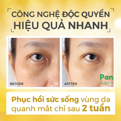 RECIPE Kem dưỡng da vùng mắt 30ML