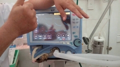 CHO THUÊ MÁY THỞ TẠI HÀ NỘI VÀ MIỀN BẮC