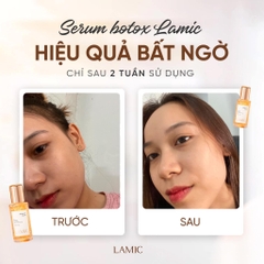 Serum Idebenone LAMIC (35ml) – Phục hồi & hỗ trợ làm chậm lão hoá da - Minie - Chọn đúng. Đẹp bền.