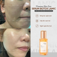 Serum cấp ẩm, hỗ trợ dưỡng trắng và phục hồi da botox tươi LAMIC 35ml