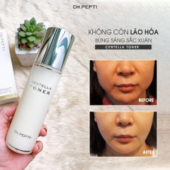 Nước Hoa Hồng Rau Má Làm Dịu, Dưỡng Sáng Da Dr.Pepti+ Centella Toner 180ml