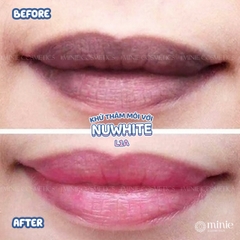 Kem làm hồng môi Nuwhite L1A Mibiti Prudente 5ml