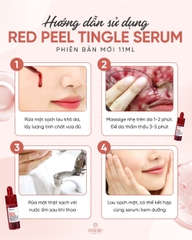 Serum So'Natural Tái Tạo Peel Da Sinh Học 11ml Red Peel Tingle Serum