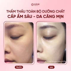 Mặt nạ dưỡng ẩm d'Alba White Truffle Nourishin Treatment Mask