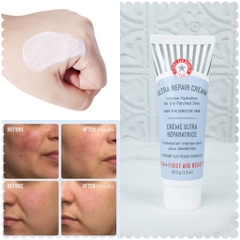 Dưỡng Ẩm First Aid Beauty Ultra Repair Cream Intense Hydration for Dry Parched Skin 28.3g