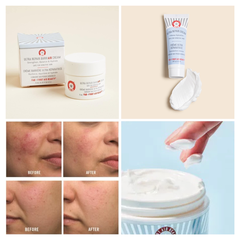 Kem Dưỡng Ẩm First Aid Beauty - Ultra Repair BarriAir Cream 9ml