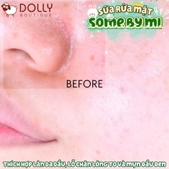 Sữa Rửa Mặt Sủi Bọt Some By Mi Bye Blackhead 30Days Greentea Tox Trị Mụn Đầu Đen 120ml